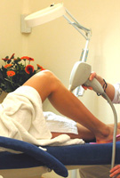 Depliacja laserowa - Kosmedica Depliacja laserowa - Kosmedica